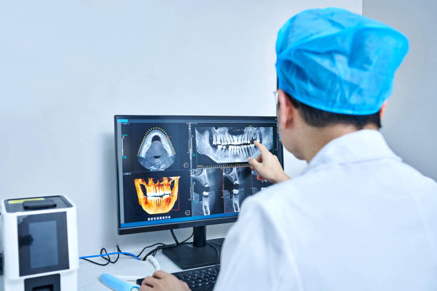 Best Emergency Wisdom Teeth Removal in Alafaya, FL